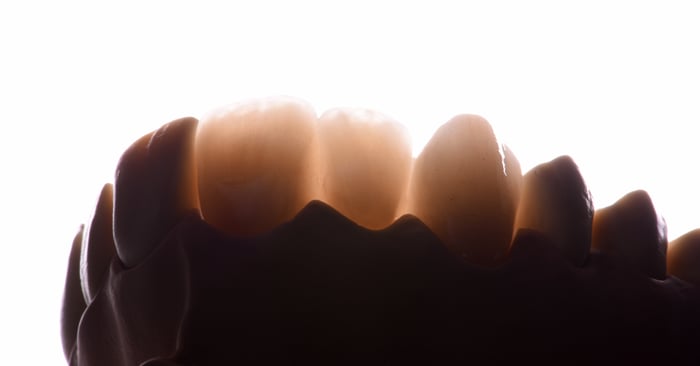 Zirconia Mania - Why All the Rage?