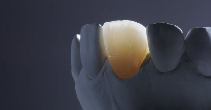 How to improve your CAD/CAM and Monolithic Restorations