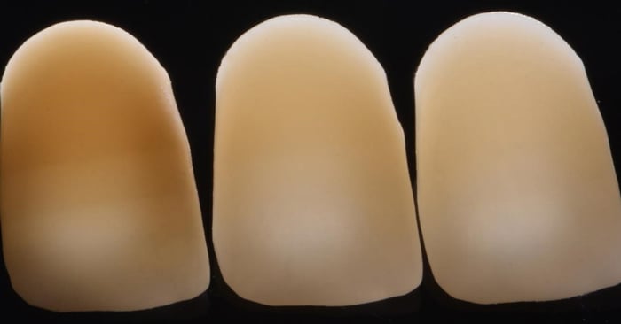¿Cómo se puede manejar la dentina pigmentada para las restauraciones directas e indirectas?