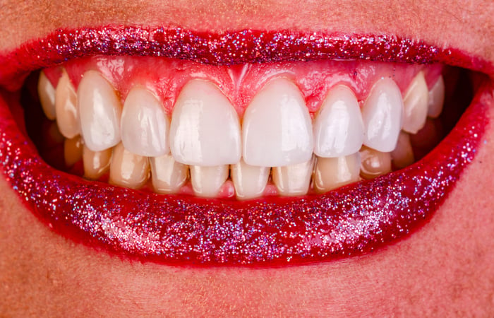 How to Get More by Doing Less—the Wow Factor of Minimal Preparation of IPS e.max Veneers
