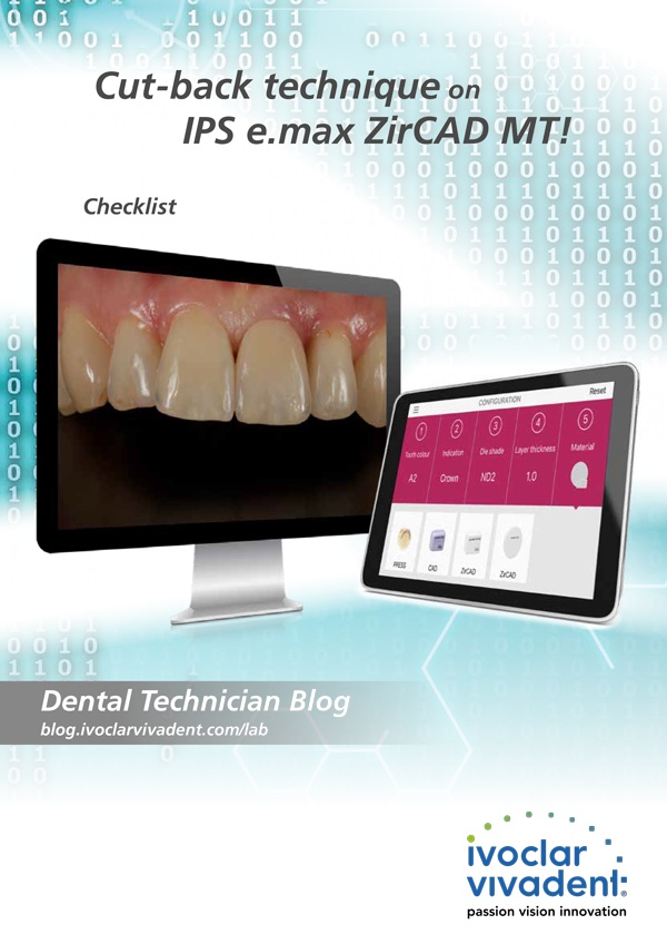 How to produce highly esthetic restorations by using the cut-back technique