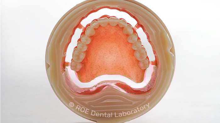A clear protocol to fabricate functional and aesthetic dentures