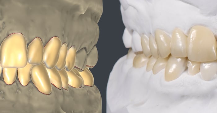 Interview: The future of dentistry will be both digital and manual