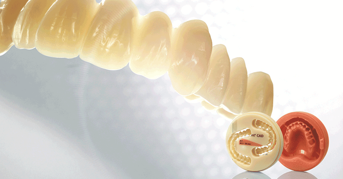 CAD/CAM: The simpler way of fabricating complete dentures