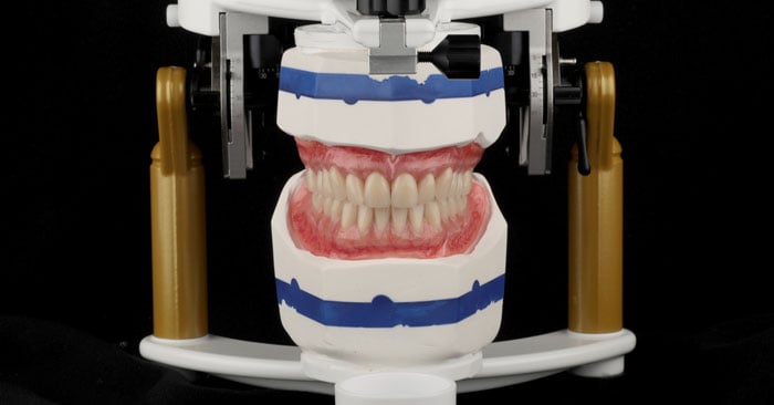 Dentes pré-fabricados para montagem de próteses