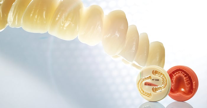 Digital Denture: kompletter Prozess zur Herstellung digitaler Zahnprothesen