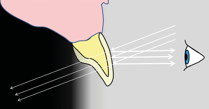 Dentin, Enamel und Co.: So gelingt Ihnen die treffende Farbwahl