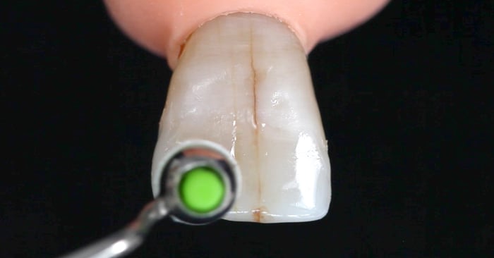 ¿Utiliza barnices para las restauraciones directas, indirectas o basadas en implantes?