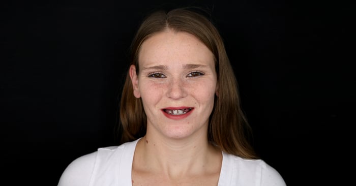 Con Digital Denture per un nuovo benessere - 1° episodio