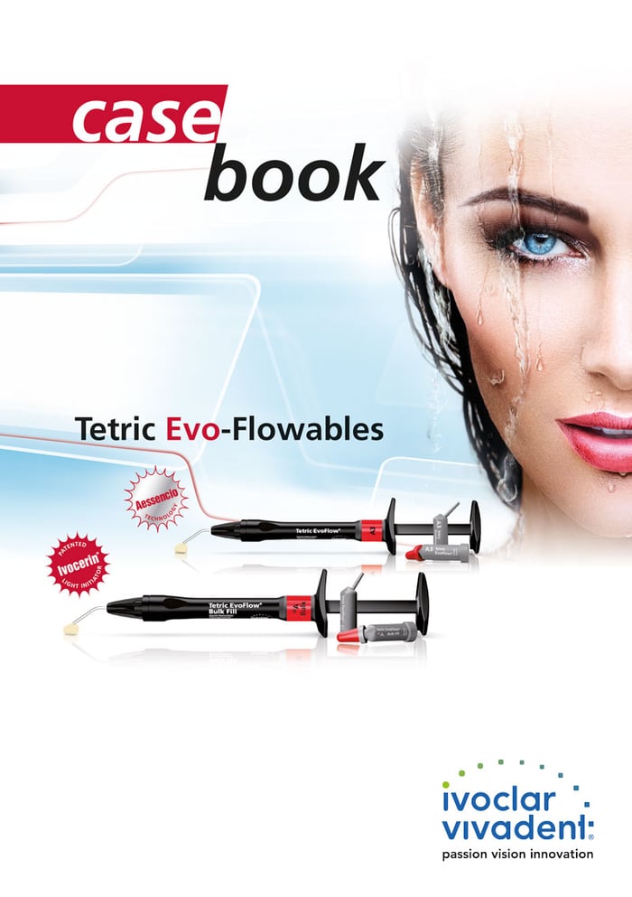 Casebook Tetric Evo-Flowables