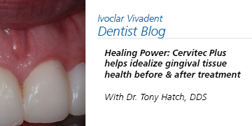Healing Power: Cervitec Plus helps idealize gingival tissue health before and after treatment.