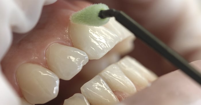 Video: Fluoride varnish – How to use it properly