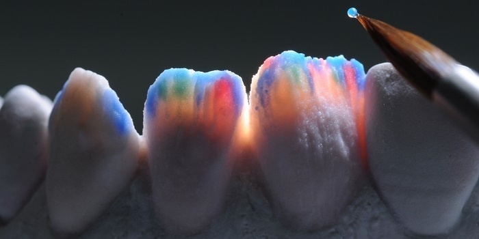 Cerámica dental: la pequeña historia de un gran descubrimiento