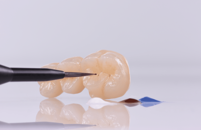 The 3D Color Integration in Monolithic Restorations