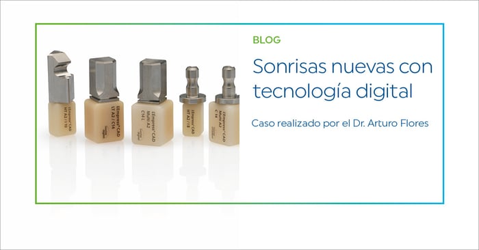 Sonrisas nuevas con tecnología digital