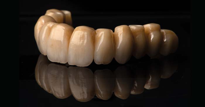 I vantaggi di Zirconia Prime