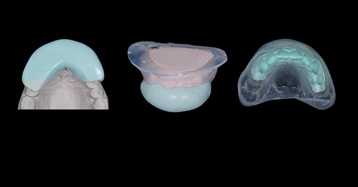 Aplicação do workflow digital em resinas injetadas com uma abordagem em Tomografia 3D